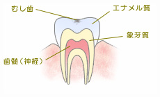 C0：脱灰