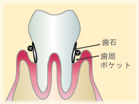 中期