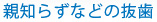 親知らずなどの抜歯
