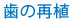 歯の再植